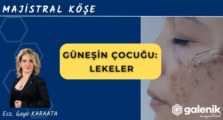 Güneş’in Çocuğu: Lekeler